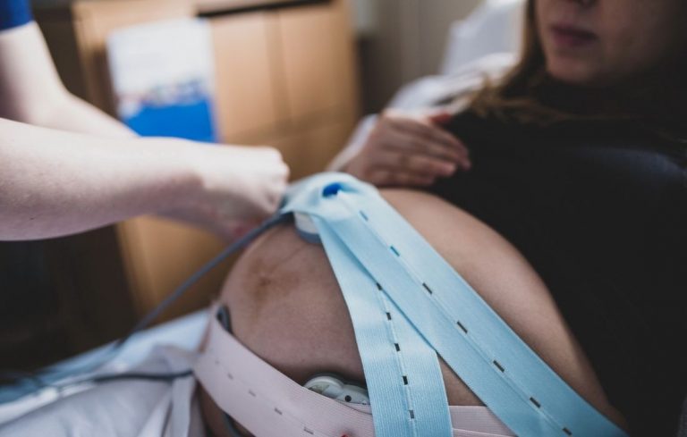 size-friendly doula helping with monitoring straps during labor