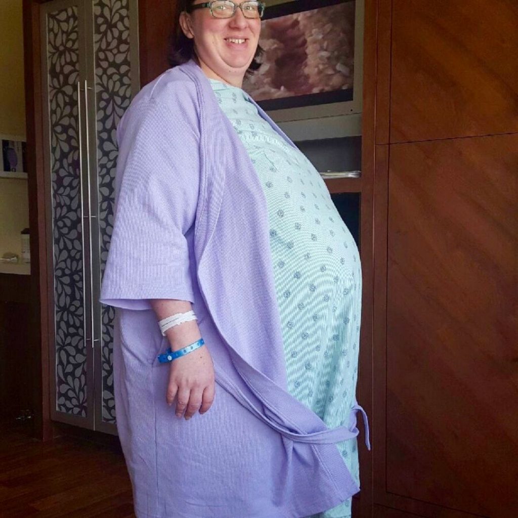 plus size woman in labor 