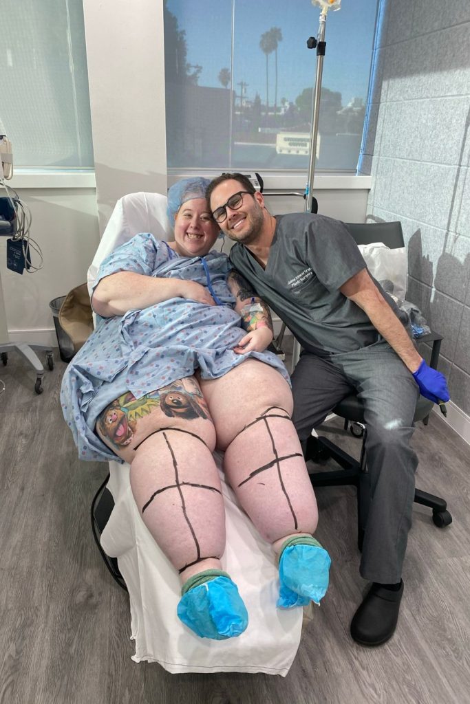 Lipedema Surgery Before And After Story - Cara's Fight For Care