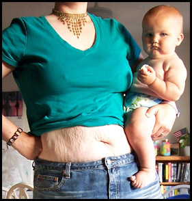 mother with postpartum body